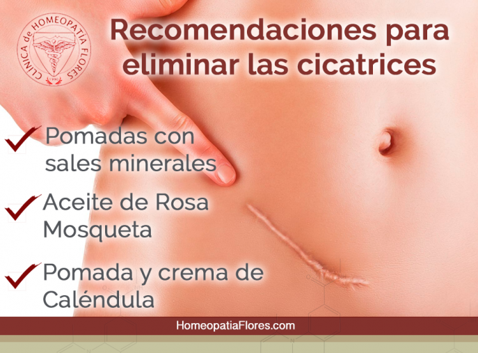 Para eliminar las cicatrices