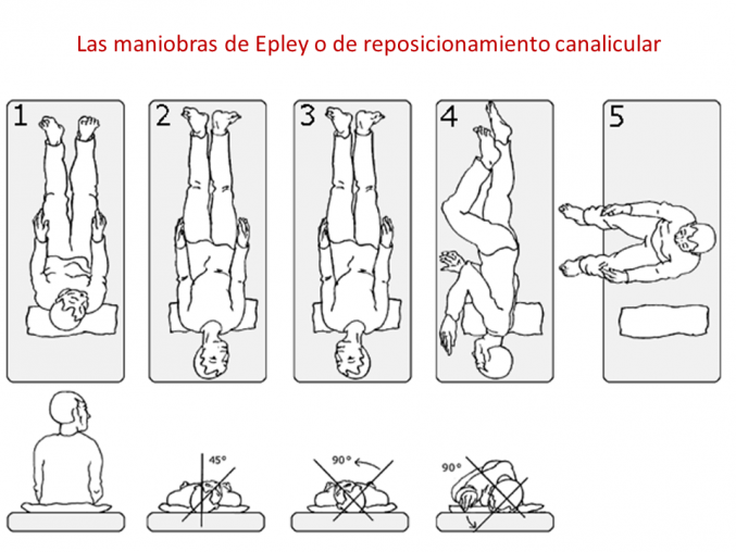 Lo mas recomendado para el vértigo