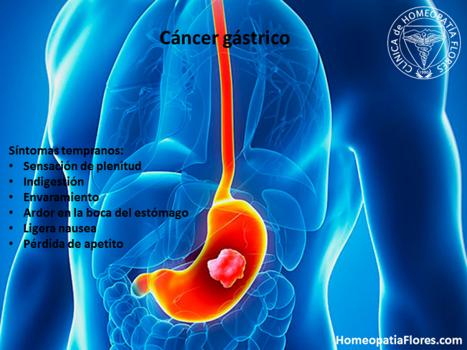 El riesgo de cáncer gástrico se duplica en quienes toman omeprazol.