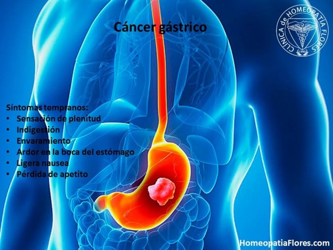 El uso a largo plazo de omeprazol duplica las posibilidades de desarrollar cáncer de estómago.