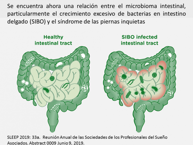 Cada vez más evidencias de la importancia de las bacterias intestinales en la salud humana