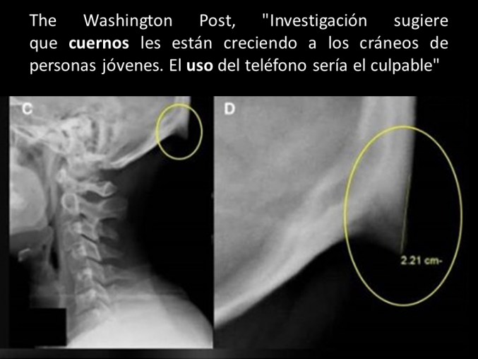 Aparecen protuberancias en los cráneos de los jóvenes