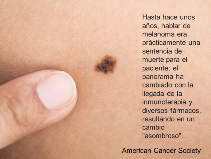 El enorme cambio del pronóstico en melanoma